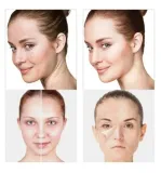 darsonval-derma-wand-darsonwal-mocny-4-peloty-stan-nowy