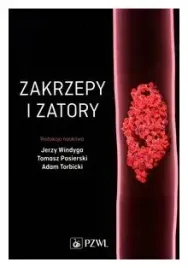 zakrzepy-i-zatory