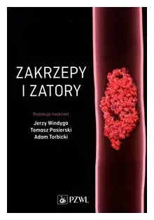 zakrzepy-i-zatory