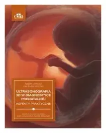 ultrasonografia-3d-w-diagnostyce-prenatalnej