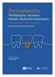 periimplantitis-profilaktyka-i-leczenie-tkanek-okolowszczepowych-gorska