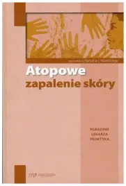 atopowe-zapalenie-skory-poradnik-lekarza-praktyka
