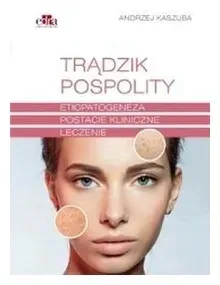 tradzik-pospolity-kaszuba-a