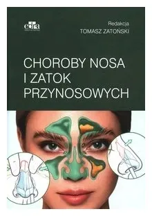Choroby nosa i zatok przynosowych Tomasz Zatoński