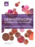 dermatoskopia-w-dermatologii-ogolnej