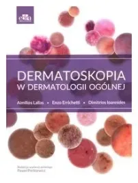 dermatoskopia-w-dermatologii-ogolnej