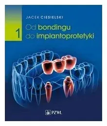 od-bondingu-do-implantoprotetyki-czesc-1