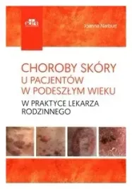 choroby-skory-u-pacjentow-w-podeszlym-wieku