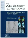 zespol-stopy-cukrzycowej