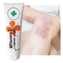 krem-z-witamina-d-na-luszczyce-egzema-suchosc-skory-skora-wrazliwa-90ml