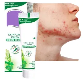 krem-z-cynkiem-na-tradzik-aloes-stany-zapalne-tradzik-hormonalny-alkohol