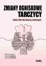 zmiany-ogniskowe-tarczycy-atlas-usg-dla-lekarzy