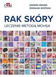 rak-skory-leczenie-metoda-mohsa-andrzej-bieniek-zdzislaw-wozniak