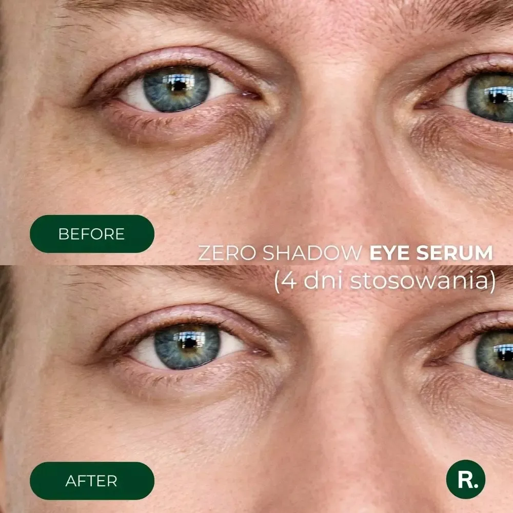zestaw-pod-oczy-zero-shadow-eye-complex-ralls