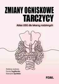 zmiany-ogniskowe-tarczycy-atlas-usg-dla-lekarzy-red-dorota-szydlarska