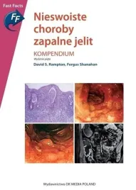 nieswoiste-choroby-zapalne-jelit