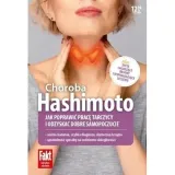 hashimoto-ringier-axel-springer-polska