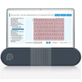 wellue-er1-hw-monitor-ekg-holter-24h-bluetooth-ecg