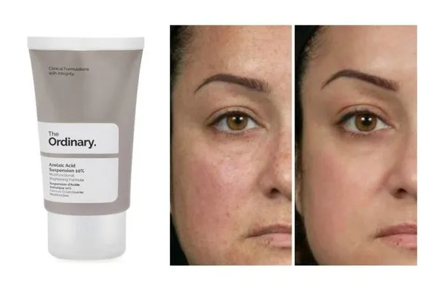 kwas-the-ordinary-10-percent-30-ml-marka-the-ordinary
