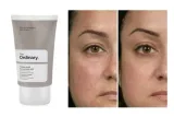 kwas-the-ordinary-10-percent-30-ml-marka-the-ordinary
