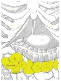 spleen-marta-szulc