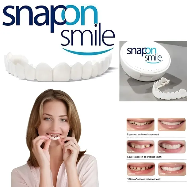 Zdejmowane licówki do zębów Snap On Smile zestaw góra i dół