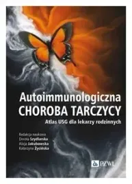 autoimmunologiczna-choroba-tarczycy-zycinska-katarzyna