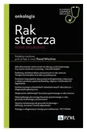 rak-stercza-nowe-spojrzenie-pawel-wiechno