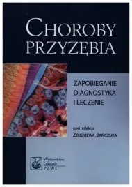 choroby-przyzebia-zapobieganie-diagnostyka-i