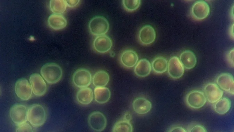kondensor-ciemnego-pola-olejowy