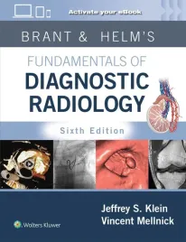 brant-and-helms-fundamentals-of-diagnostic-radiology-print-ebook-with-mul