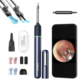 ostoskop-urzadzenie-do-czyszczenia-uszu-woskowiny-bebird-note5-niebieskie