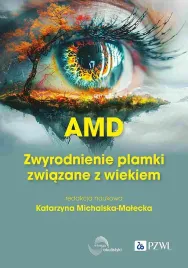 amd-zwyrodnienie-plamki-zoltej-zwiazane-z-wiekiem-katarzyna-michalska-malecka
