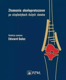 zlamania-okoloprotezowe-po-aloplastykach-duzych-stawow-golec-edward