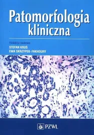 patomorfologia-kliniczna-pzwl