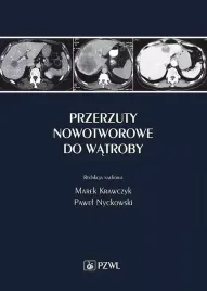 przerzuty-nowotworowe-do-watroby
