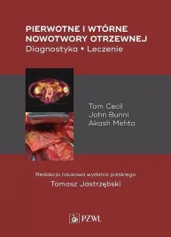 pierwotne-i-wtorne-nowotwory-otrzewnej-cecil-tom-bunni-john-mehta-akash