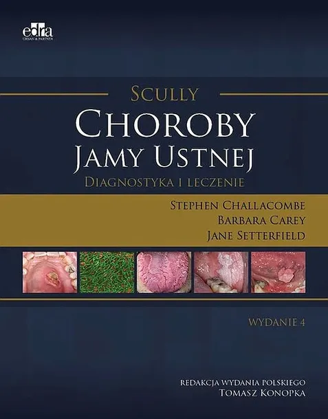 CHOROBY JAMY USTNEJ. DIAGNOSTYKA I LECZENIE. SCULLY - Challacombe S. , Carey ,B. Setterfield J. - Konopka T.
