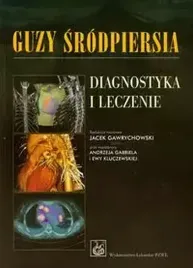 guzy-srodpiersia-diagnostyka-i-leczenie