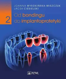 od-bondingu-do-implantoprotetyki-cz-ii-joanna-wysokinska-miszczuk-jacek-ciesielski