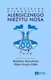 nowoczesna-diagnostyka-alergicznego-niezytu-nosa-boleslaw-samolinski-edyta-krzych-falta