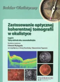 zastosowanie-optycznej-koherentnej-tomografii-w-okulistyce-czesc-2-wylegala-edward-nowinska-anna-teper-slawomir