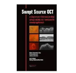 swept-source-oct-romanowska-dixon-bozena-jakubowska-barbara-karska-basta-izabella