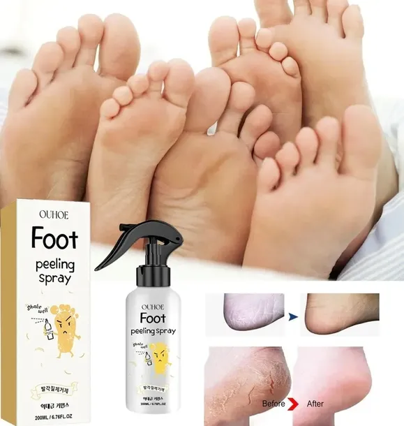 UHOE Foot Peeling Spray – Spray do złuszczania skóry stóp