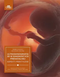ultrasonografia-3d-w-diagnostyce-prenatalnej-r-chaoui-janowska-e-bielasik-k
