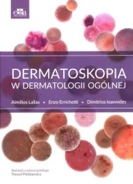 dermatoskopia-w-dermatologii-ogolnej-a-lallas-d-ioannides-e-errichetti