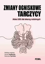 zmiany-ogniskowe-tarczycy-dorota-szydlarska-katarzyna-zycinska