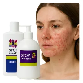 jak-pozbyc-sie-nuzenca-na-twarzy-zel-tonik-do-twarzy-ciala-stop-demodex