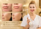 zestaw-darsonval-derma-wand-vigomed-30w-7-elektrod-model-de-07
