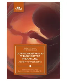 ultrasonografia-3d-w-diagnostyce-prenatalnej